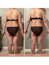 リファラ 光の森店(REFALA)/【痩身/20代女性】約3ヶ月の結果