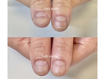 アーティネイルズ(Aaty Nails)/どんな爪も驚きません