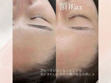 エマイミー 品川(EmayMie)/フェイシャルWAXでツヤ肌☆