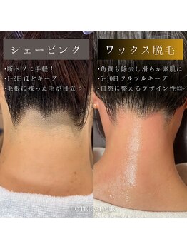 ホテルアンドパーク(HOTEL&PARK.)/うなじワックス脱毛/Mizuki施術