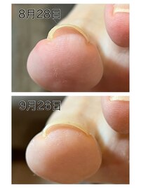 一度の施術でこの効果！