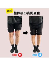 ベルス(BELTH)/姿勢変化－O脚－