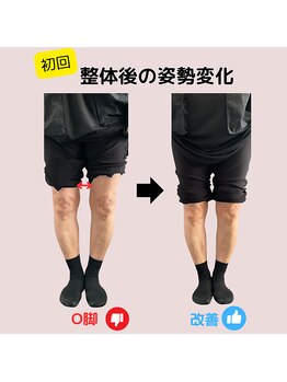 ベルス(BELTH)/姿勢変化－O脚－