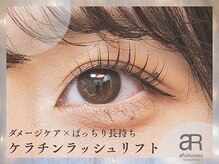 アルムビュー(aRumubeau)