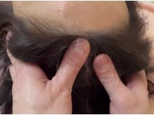 お顔のリハビリを基にした施術で頭蓋骨を引き締めリフトアップ