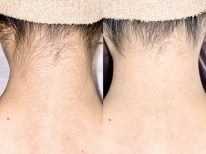 エクレ 柏店(EKURE)の写真