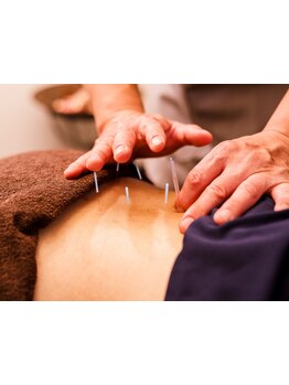 鍼灸施術を受けたい