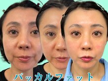 ナチュラルビューティーフェイス 横浜(NBF)