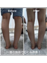 モナと雲と楽/全身-VIP-マッサージ