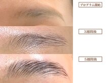ルナクレスタ 門前仲町店(Luna Cresta)/眉毛プログラム【アイブロウ】