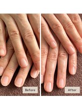 マニュキュア(Manicure)/手荒れ改善