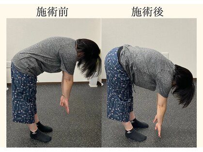 ブロッサム(Blossom)の写真