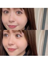 アンユー(an.u)/LED/マツエク/上下