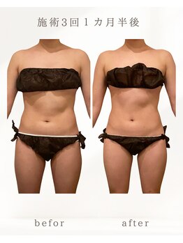 ナチュラル ビューティー スタイル さらさ(Natural Beauty Style)/短期集中コース