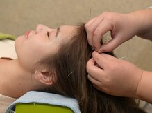 エイトはり きゅう院/頭の疲れも鍼におまかせ！