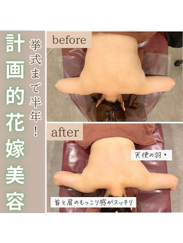 エステ ココ 荻窪店(Esthe CoCo)/美肌/肌管理/痩身