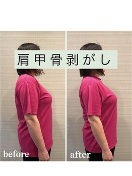 ギャラクシービューティー(galaxy beauty)/肩甲骨はがし