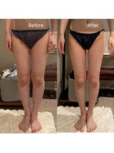 ココシア(cococia)/3回での変化です