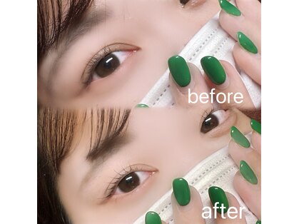 ヴィヴィッド(vivid)の写真