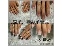 ネイル サロンアンドスクール リッシュ(Nail Salon&School riche)の雰囲気（噛み爪深爪育成で美爪に！綺麗に楽しみながら育てていきます！）