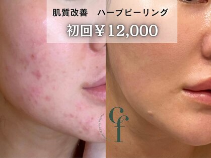 コノフィ 福岡天神大名店の写真