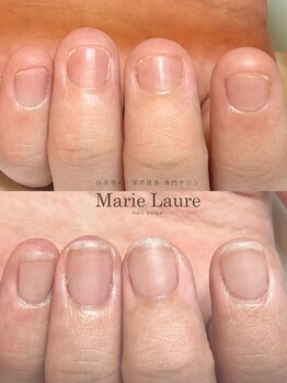 マリーロール 梅田店(Marie Laure)/自爪育成/深爪矯正/ネイルケア