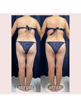 トレス(Tres)/インディバ120分