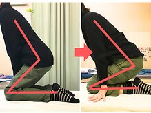 杉本接骨鍼灸院/膝の症状例：施術を受けた方の声