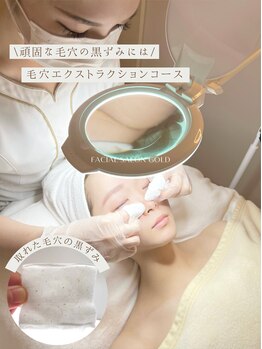 ゴールド 恵比寿店(GOLD)/話題の毛穴エクストラクション