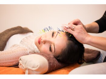 北梅田美容鍼灸院/【大阪/梅田】美容鍼灸