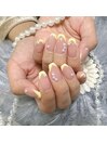 変形フレンチ/黄色