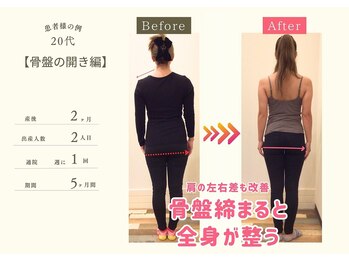ココア整体 岐阜店(cocoa整体)/産後骨盤矯正/整体