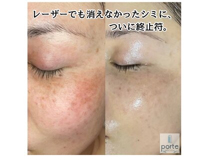 ポルテ(porte)の写真