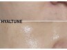 【韓国水光肌へ♪】HYALTUNE ￥14,520