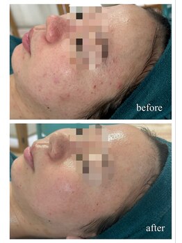 リノルーア(Linolua)/