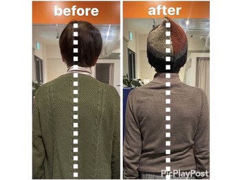 カワル整体 上通り院/手の痺れ・ふるえ