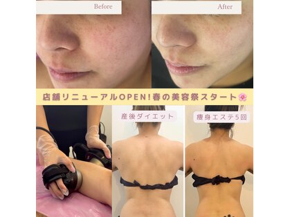 ラ レーヌ(La-leine)の写真