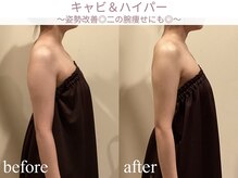 エステティックサロン アールグレー 名古屋駅店/花嫁も絶賛♪二の腕引き締め◎