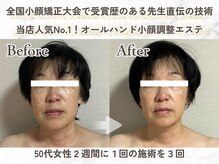 メイヴィ 四日市(Maivi)の雰囲気(痛みの少ない施術で無理なく自然な輪郭形成◎5歳若見えを実感♪)