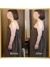 ルマ(Rumah)/スマホで首肩が辛い・腕が重い