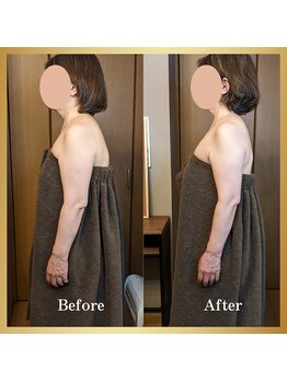 ルマ(Rumah)/スマホで首肩が辛い・腕が重い