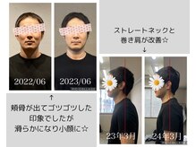 身体の変化と共にお顔も別人の印象に☆