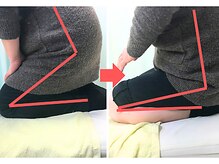 杉本接骨鍼灸院/膝の症状例：施術を受けた方の声