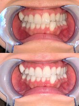 ライトビューティー 池袋店(LightBeauty)/症例写真