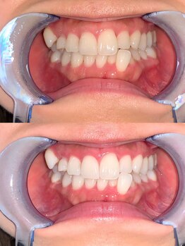 ライトビューティー 池袋店(LightBeauty)/症例写真