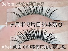 ラグーン(LAGOON)/バインドロック