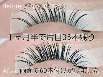 ラグーン(LAGOON)/バインドロック