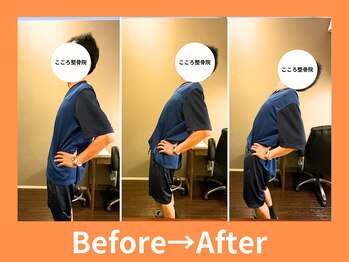 こころ整骨院/50代男性のビフォーアフター