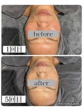 アンドココ(&coco)/ENVIRON トリートメント