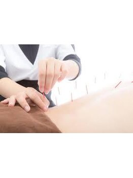 鍼灸施術を受けたい